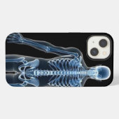 John Doe X-ray iPhone Hoesje (Achterkant horizontaal)