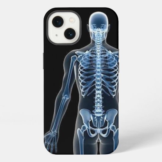 John Doe X-ray iPhone Hoesje (Achterkant)