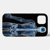 John Doe X-ray iPhone / iPad hoesje (Achterkant (horizontaal))