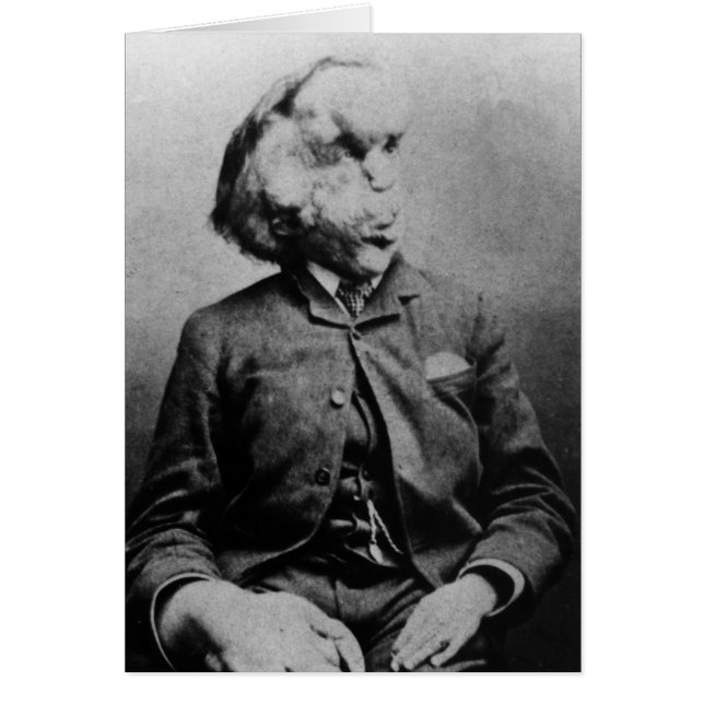Joseph "John" Merrick The Elephant Man uit 1889 (Voorkant)