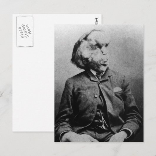 Joseph "John" Merrick The Elephant Man uit 1889 Briefkaart (Voorkant / Achterkant)