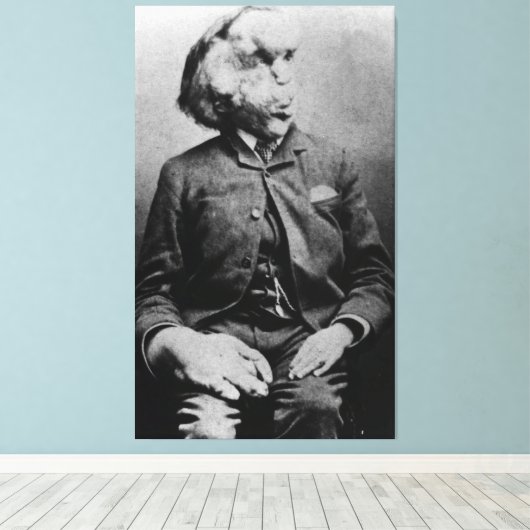 Joseph "John" Merrick The Elephant Man uit 1889 Canvas Afdruk (Insitu (Houten vloer))