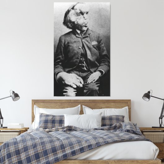 Joseph "John" Merrick The Elephant Man uit 1889 Canvas Afdruk (Insitu (Slaapkamer))