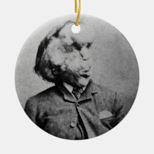 Joseph "John" Merrick The Elephant Man uit 1889 Keramisch Ornament (Voorkant)