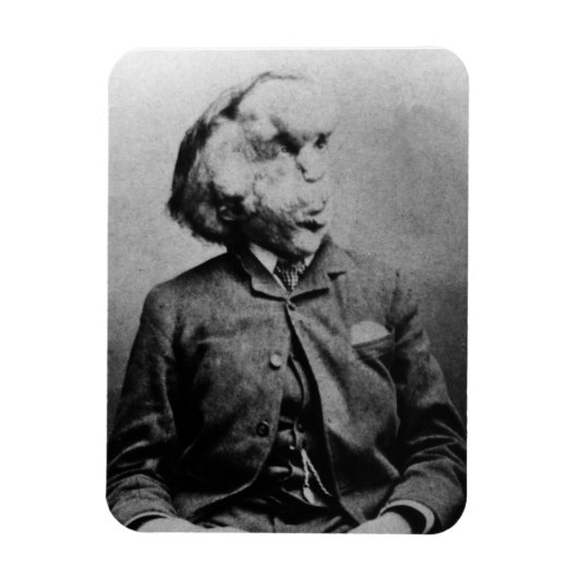 Joseph "John" Merrick The Elephant Man uit 1889 Magneet (Verticaal)