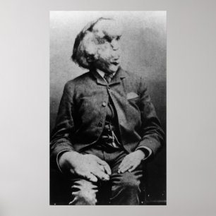 Joseph "John" Merrick The Elephant Man uit 1889 Poster