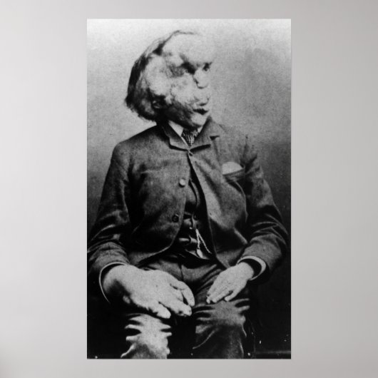 Joseph "John" Merrick The Elephant Man uit 1889 Poster (Voorkant)