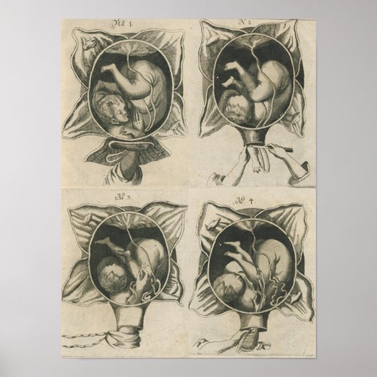 Justine Siegemund Court Verloskundige Zwangerschap Poster (Voorkant)