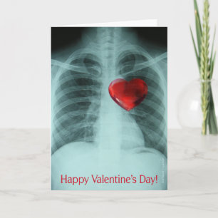 Kaart van röntgenfoto Valentijns