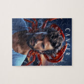 Kanker Mannelijke Jigas Puzzel (Horizontaal)