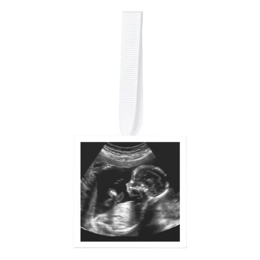 Kerst Zwangerschap Aankondiging Ultrasound Foto Decoratie (Voorkant)