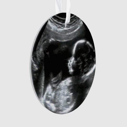 kerstBaby Sonogram Afbeelding Gift Ornament (voorkant)