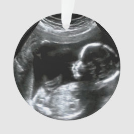 kerstBaby Sonogram Afbeelding Gift Ornament