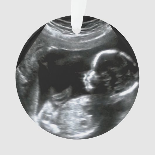 kerstBaby Sonogram Afbeelding Gift Ornament (voorkant)