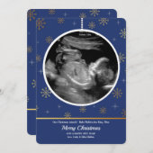 Kerstversiering Echografie Kerstkaart (Voorkant / Achterkant)