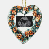 Kerstzwangerschapsecho Baby op komst Keramisch Ornament (Links)