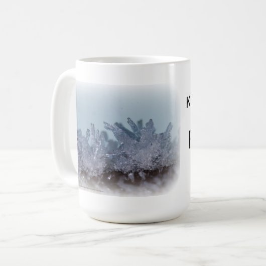 Kidney Stones Rock Mijn wereld! Mok (Voorkant links)