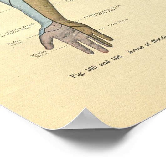  kikkerboog Nerve-ventilatie-afdruk Poster (Hoek)