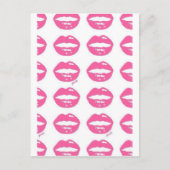 Kisses Briefkaart (Voorkant)