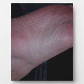 KLIK NU OP MIJN VOET! FOTOPLAAT (Voorkant)