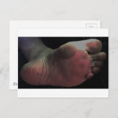 KLIK OP MIJN ENKEL BRIEFKAART (Voorkant / Achterkant)