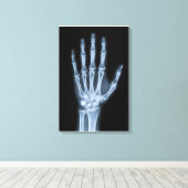 Klinische Röntgenfoto van een hand Canvas Afdruk (Insitu (Houten vloer))