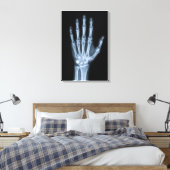 Klinische Röntgenfoto van een hand Canvas Afdruk (Insitu (Slaapkamer))