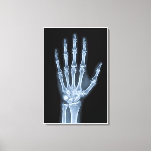 Klinische Röntgenfoto van een hand Canvas Afdruk (Voorkant)