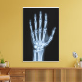 Klinische Röntgenfoto van een hand Canvas Afdruk (Insitu (Woonkamer))