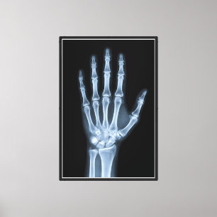 Klinische Röntgenfoto van een hand Canvas Afdruk