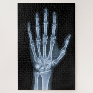 Klinische Röntgenfoto van een hand Legpuzzel