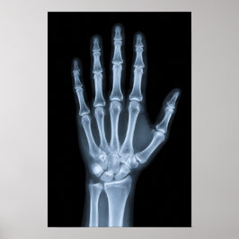 Klinische Röntgenfoto van een hand Poster