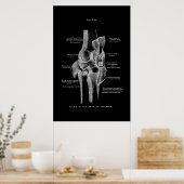 Knee Joint Anatomy Medical Wall Decor Poster (Keuken)