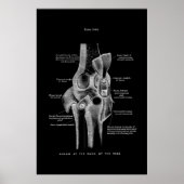 Knee Joint Anatomy Medical Wall Decor Poster (Voorkant)