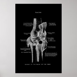Knee Joint Anatomy Medical Wall Decor Poster