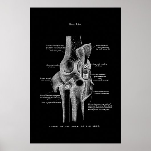 Knee Joint Anatomy Medical Wall Decor Poster (Voorkant)