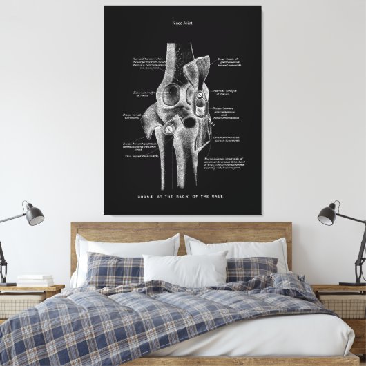 Knee Joints Anatomy Art Canvas Afdruk (Insitu (Slaapkamer))