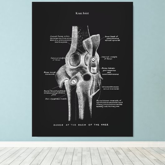 Knee Joints Anatomy Art Canvas Afdruk (Insitu (Houten vloer))