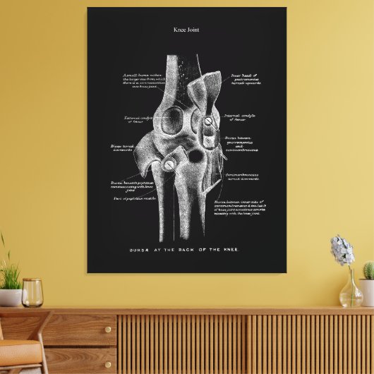 Knee Joints Anatomy Art Canvas Afdruk (Insitu (Woonkamer))