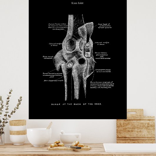 Knee Joints Anatomy Art Poster (Keuken)