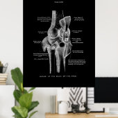 Knee Joints Anatomy Art Poster (Thuiskantoor)