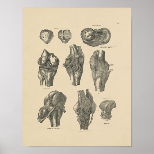  knie Joint Anatomy 1880 Print (Voorkant)