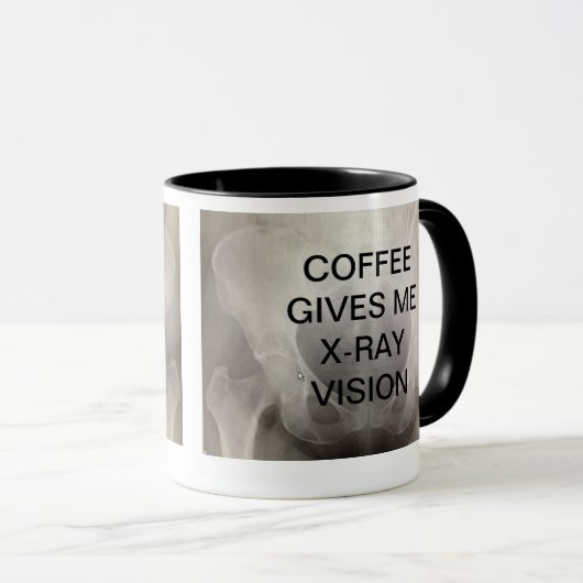 KOFFIE GEEFT ME X-RAY VISION MOK (Voorkant rechts)