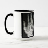 Koningin in de hand-röntgenfoto mok (Links)