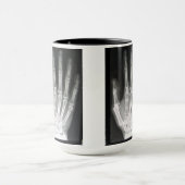 Koningin in de hand-röntgenfoto mok (Midden)