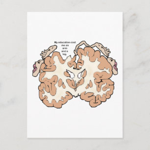 Kost een arm en een beenhomunculus briefkaart