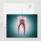 Kruissectie van een menselijke tand briefkaart (Voorkant / Achterkant)