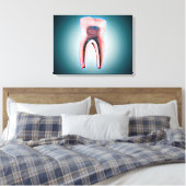 Kruissectie van een menselijke tand canvas afdruk (Insitu (Slaapkamer))