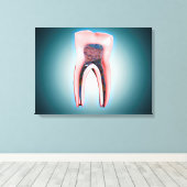 Kruissectie van een menselijke tand canvas afdruk (Insitu (Houten vloer))