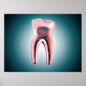 Kruissectie van een menselijke tand poster (Voorkant)